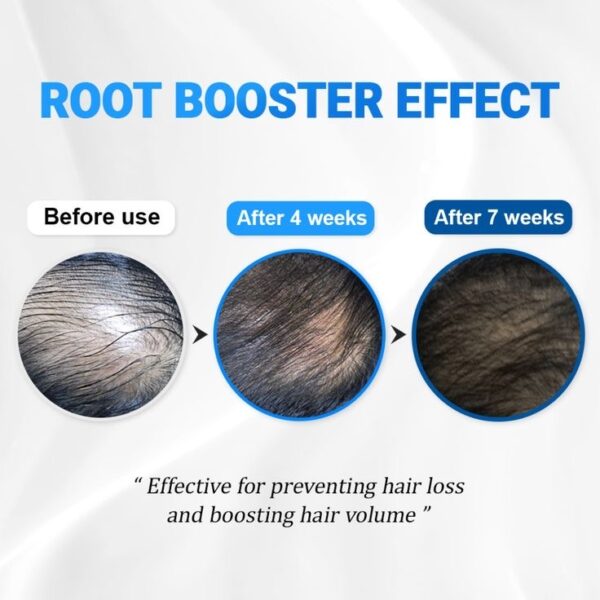 Scalp Revitalizing Serum – Hair Growth & Follicle Booster - Image 3