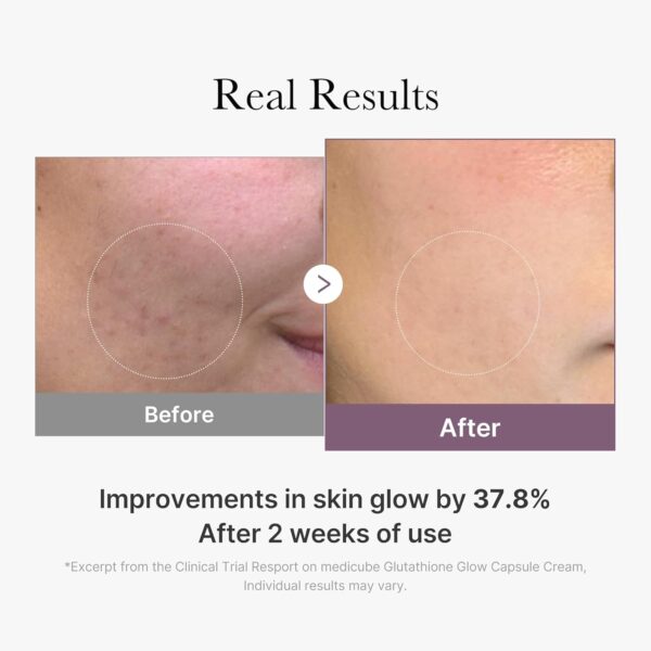 Glutathione Glow Capsule Cream - Image 6
