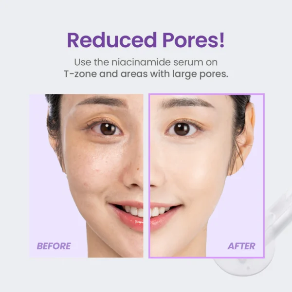 TIRTIR – Niacinamide 20% Serum - Image 4