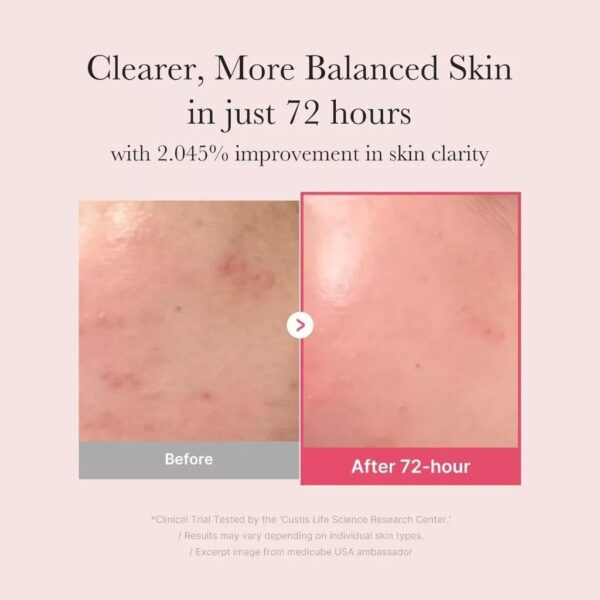 Dark Spot Correcting Glow Serum – TXA 5% + Niacinamide 10% - Image 3
