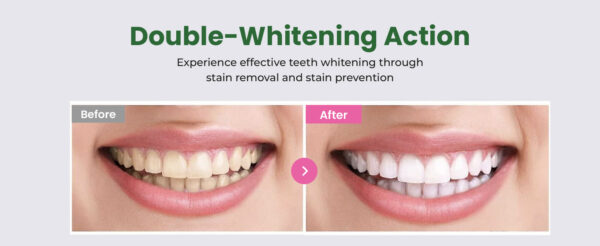 Euthymol – Original Whitening Toothpaste - Image 2
