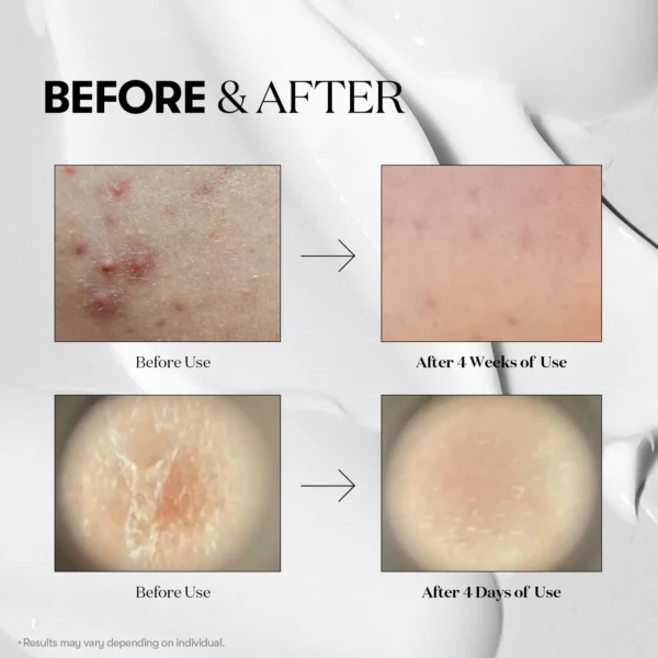 VT COSMETICS Reedle shot 100 - Image 3