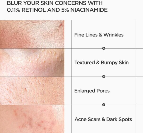 Anua - Nano Retinol 0.3% + Niacin Renewing Serum | سيروم الريتينول والنياسيناميد لتجديد البشرة وتفتيحها – 30مل - Image 4