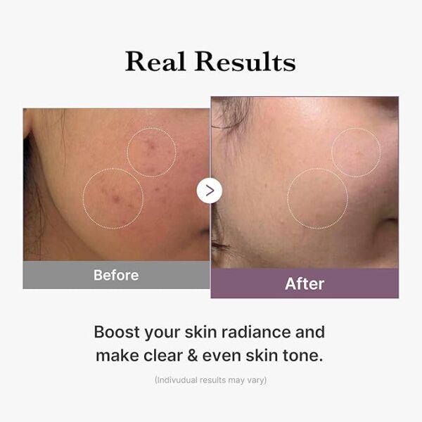 MEDICUBE – AGE-R Glutathione Glow Toner 140ml - Image 4
