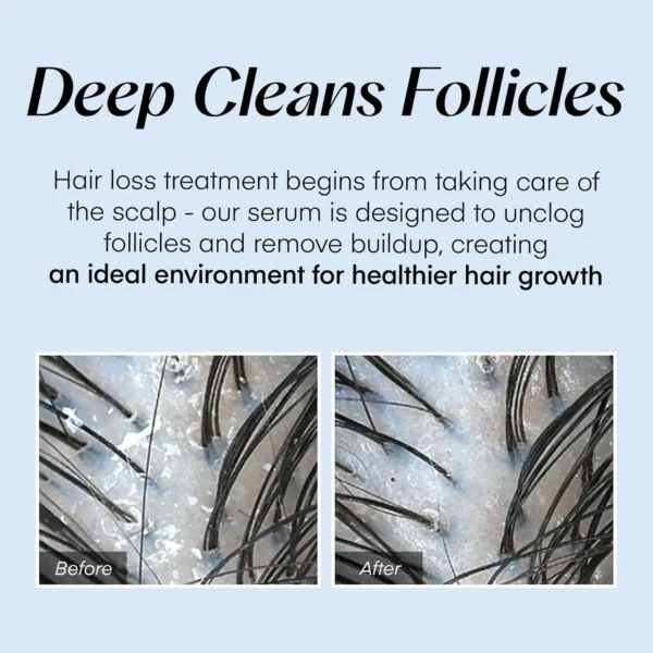 Scalp Revitalizing Serum – Hair Growth & Follicle Booster - Image 4