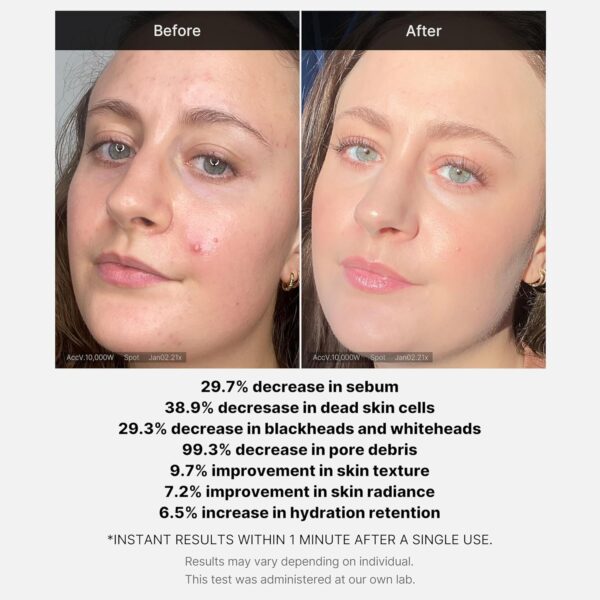 Red Succinic Acid Serum - Image 5