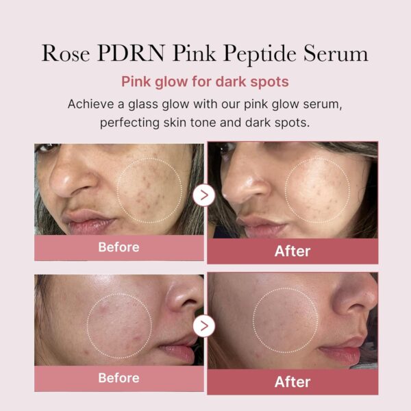Medicube – PDRN Pink Peptide Serum - Image 4