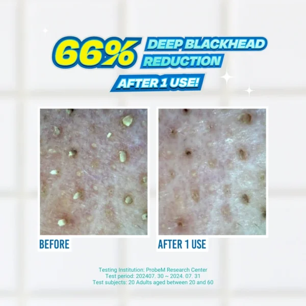 Blackhead Melting Softener 150ml - Image 3