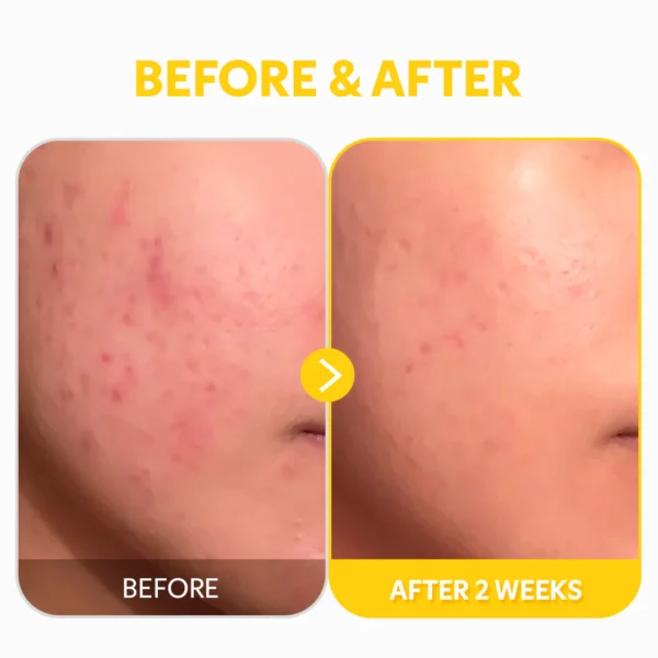 TIRTIR - Pure Vitamin C24 Serum - Image 6