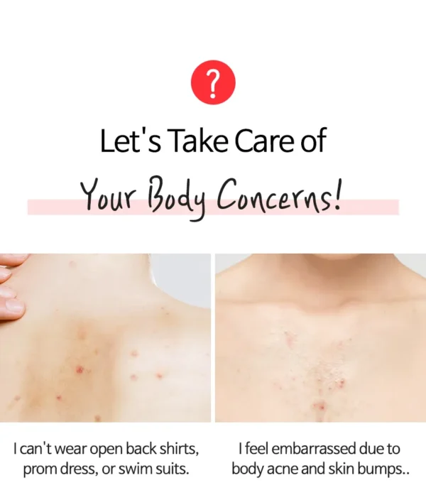 TIA'M - Anti Blemish Body Lotion Back & Chest - Image 3
