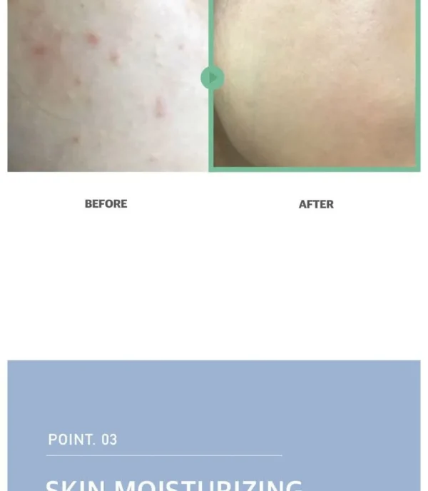 Ji Woo Gae Heartleaf BHA Peeling Pad - Image 4