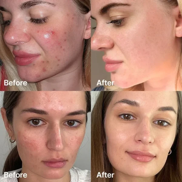 Red Succinic Acid Serum - Image 6