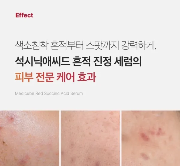 Red Succinic Acid Serum - Image 7