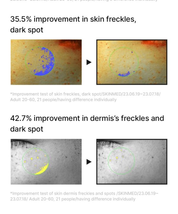 Celimax – Pore + Dark Spot Brightening Serum - Image 8