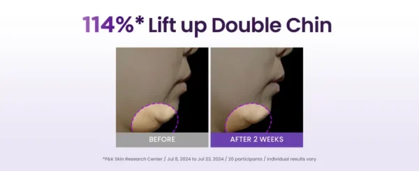 Probioderm 3D Lifting Full Face Tension Gel Mask - Image 5