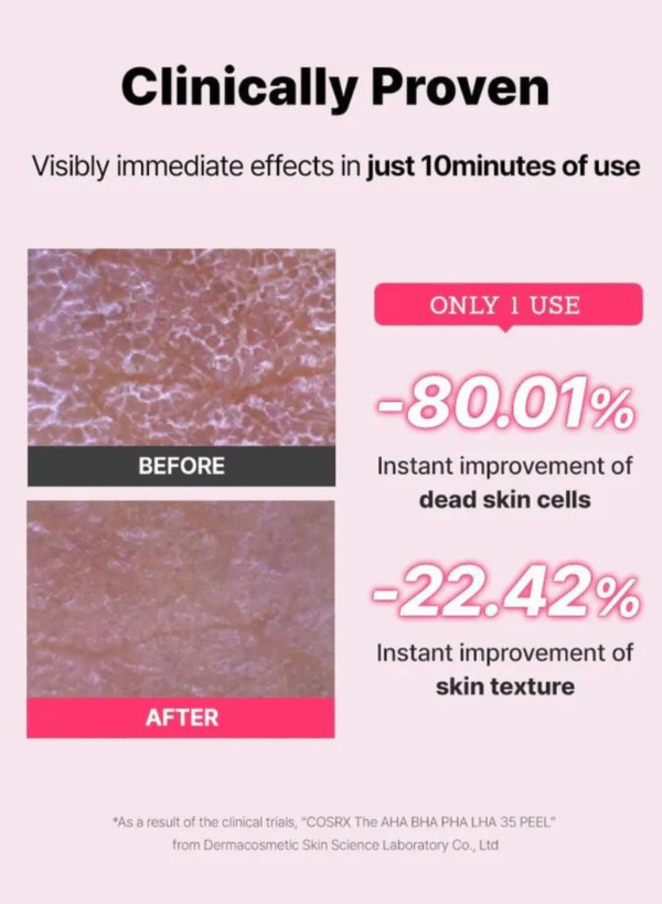 COSRX The AHA BHA PHA LHA 35 Peel | مقشر الأحماض المتعددة 35% من كوزركس – 30 مل - Image 6
