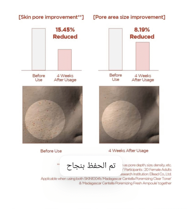 Poremizing Fresh Ampoule – أمبولة شد وتنظيف المسام - Image 2