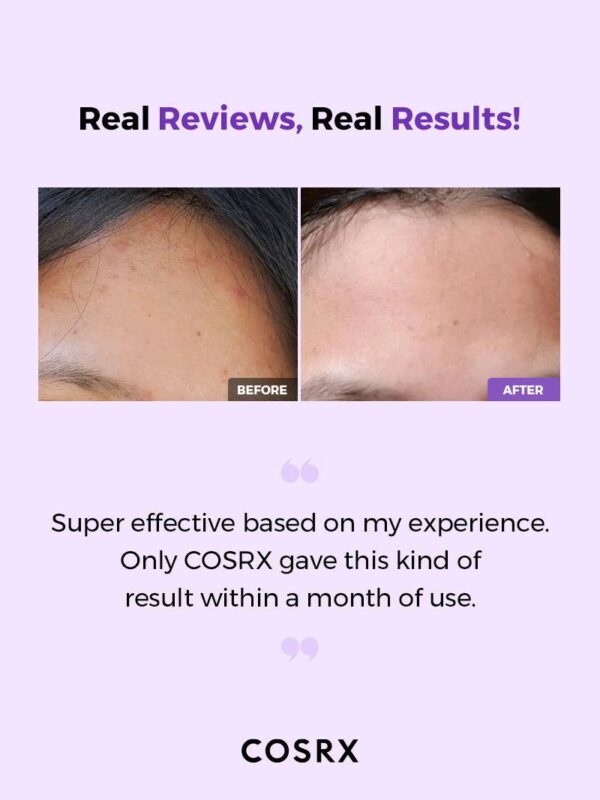 COSRX – تونر بخاخ منقي بحمض ألفا وبيتا هيدروكسي AHA/BHA – 150 مل - Image 4