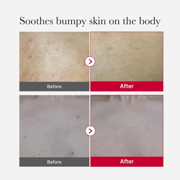 Medicube – Red Body Peeling Shot 110g - Image 4