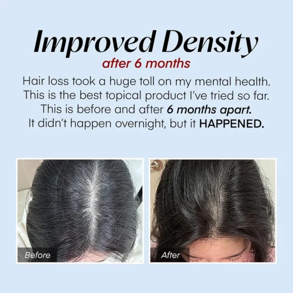Scalp Revitalizing Serum – Hair Growth & Follicle Booster - Image 8