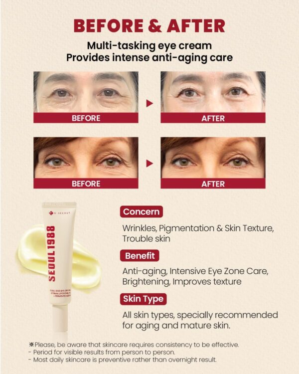 KSECRET SEOUL 1988 – Eye Cream | كريم العيون بالريتينال والفول المخمّر - Image 2