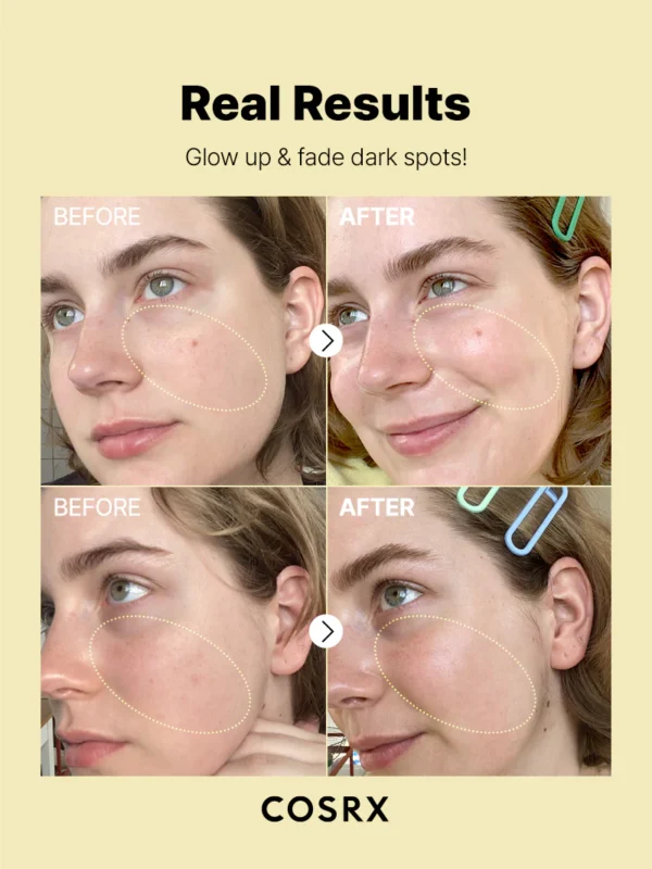 COSRX Vitamin C 23 Serum | سيروم فيتامين سي المركز 23% من كوزركس – 20 مل - Image 3