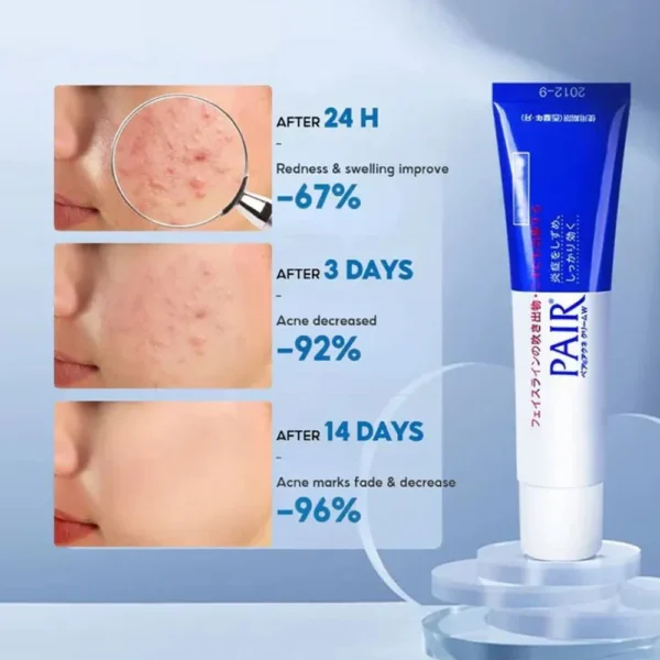 LION – Pair Acne Cream W - Image 3
