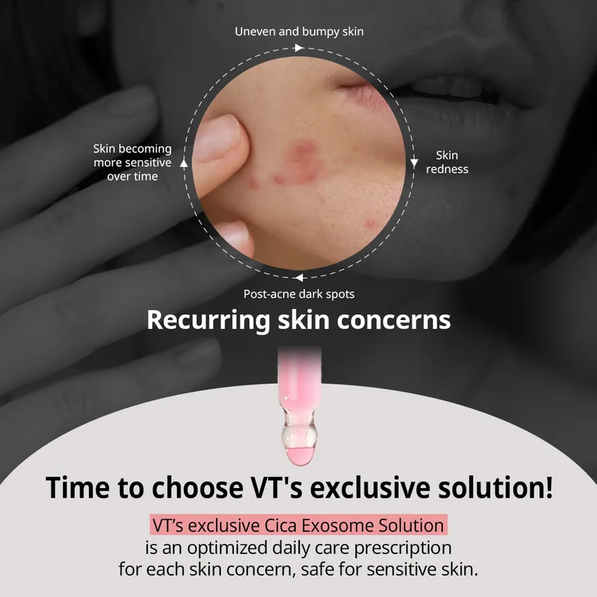 VT - Azelaic A1 Calming Ampoule - Image 3