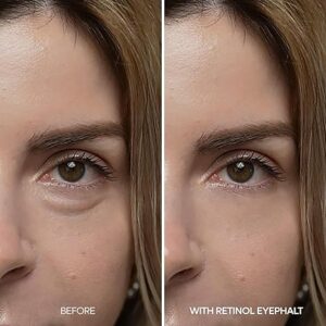 Dr.Melaxin – Eyephalt Retinol Eyebag Cream (10g)